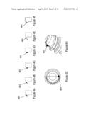 BONE SCREW WITH INSERT diagram and image