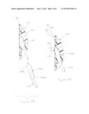 Appliance for an Electromagnetic Spectrum Sensor Monitoring an     Intravascular Infusion diagram and image