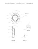 Dressing for an Insertion Site of an Intravascular Infusate diagram and image