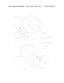 Dressing for an Insertion Site of an Intravascular Infusate diagram and image