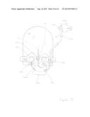 Dressing for an Insertion Site of an Intravascular Infusate diagram and image