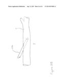 Geometry of a Transcutaneous Sensor diagram and image