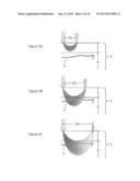 Geometry of a Transcutaneous Sensor diagram and image