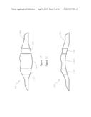 Geometry of a Transcutaneous Sensor diagram and image