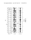 HEART SOUND SENSING TO REDUCE INAPPROPRIATE TACHYARRHYTHMIA THERAPY diagram and image