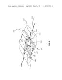 ORTHOTIC BRACE TIGHTENING DEVICE diagram and image