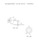 ANCHORED ABLATION CATHETER diagram and image