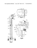 TIBIAL GUIDE FOR KNEE SURGERY diagram and image