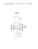 TIBIAL GUIDE FOR KNEE SURGERY diagram and image