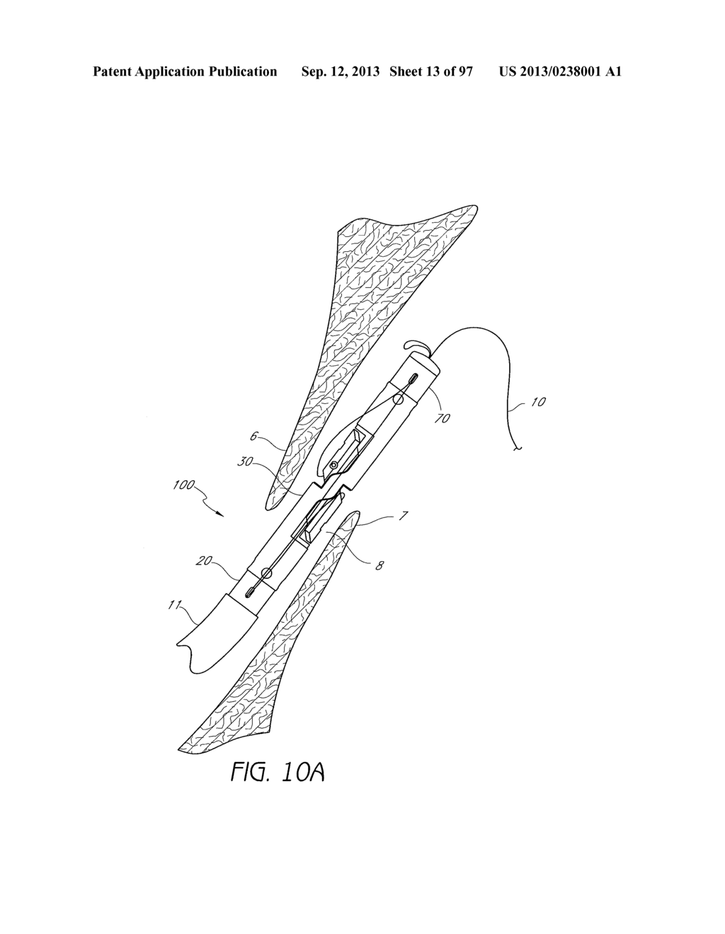 Suturing Devices and Methods for Closing a Patent Foramen Ovale - diagram, schematic, and image 14