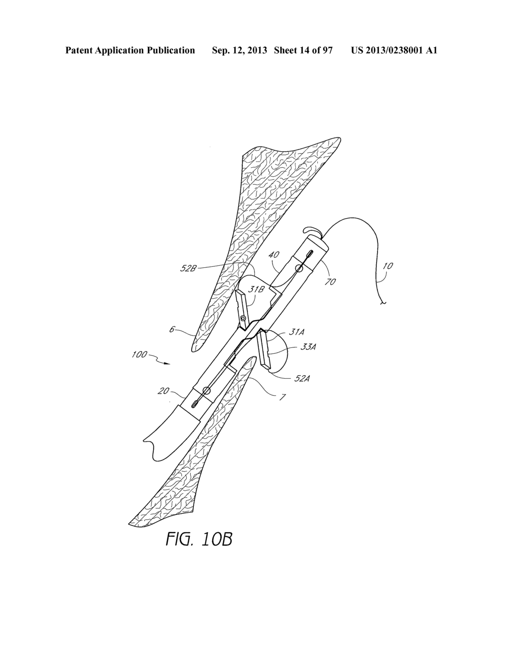 Suturing Devices and Methods for Closing a Patent Foramen Ovale - diagram, schematic, and image 15
