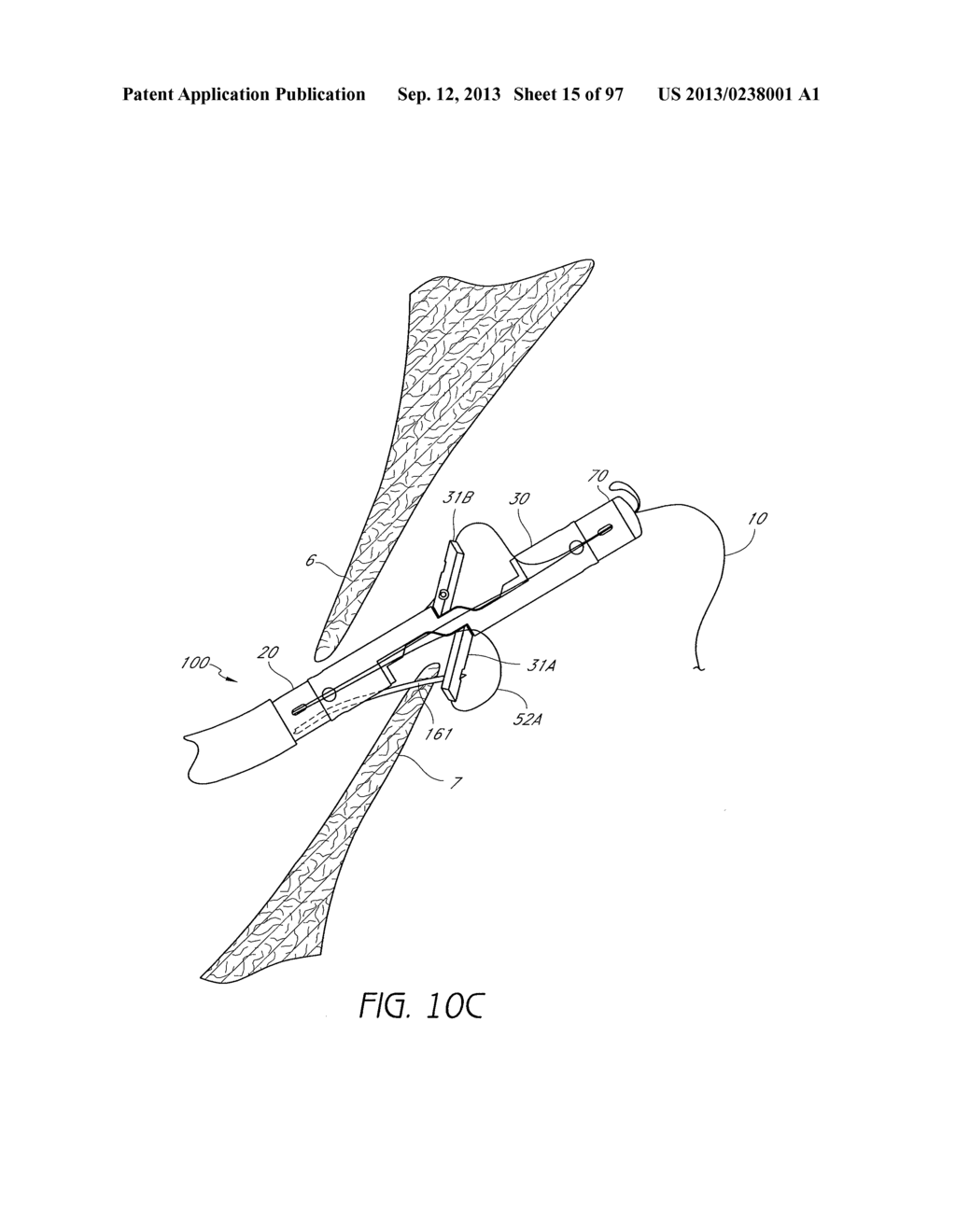 Suturing Devices and Methods for Closing a Patent Foramen Ovale - diagram, schematic, and image 16