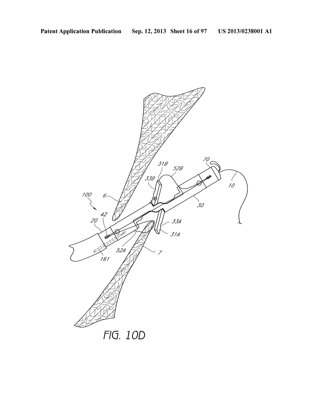 Suturing Devices and Methods for Closing a Patent Foramen Ovale - diagram, schematic, and image 17