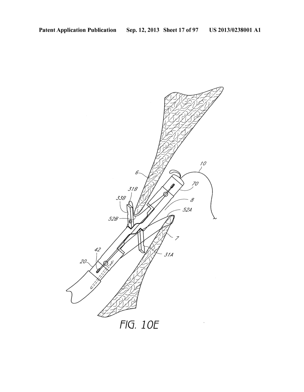 Suturing Devices and Methods for Closing a Patent Foramen Ovale - diagram, schematic, and image 18