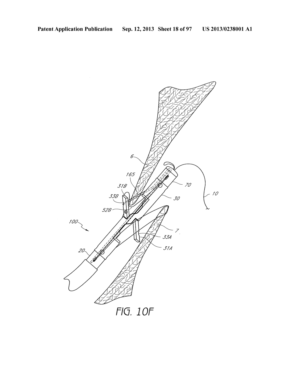 Suturing Devices and Methods for Closing a Patent Foramen Ovale - diagram, schematic, and image 19