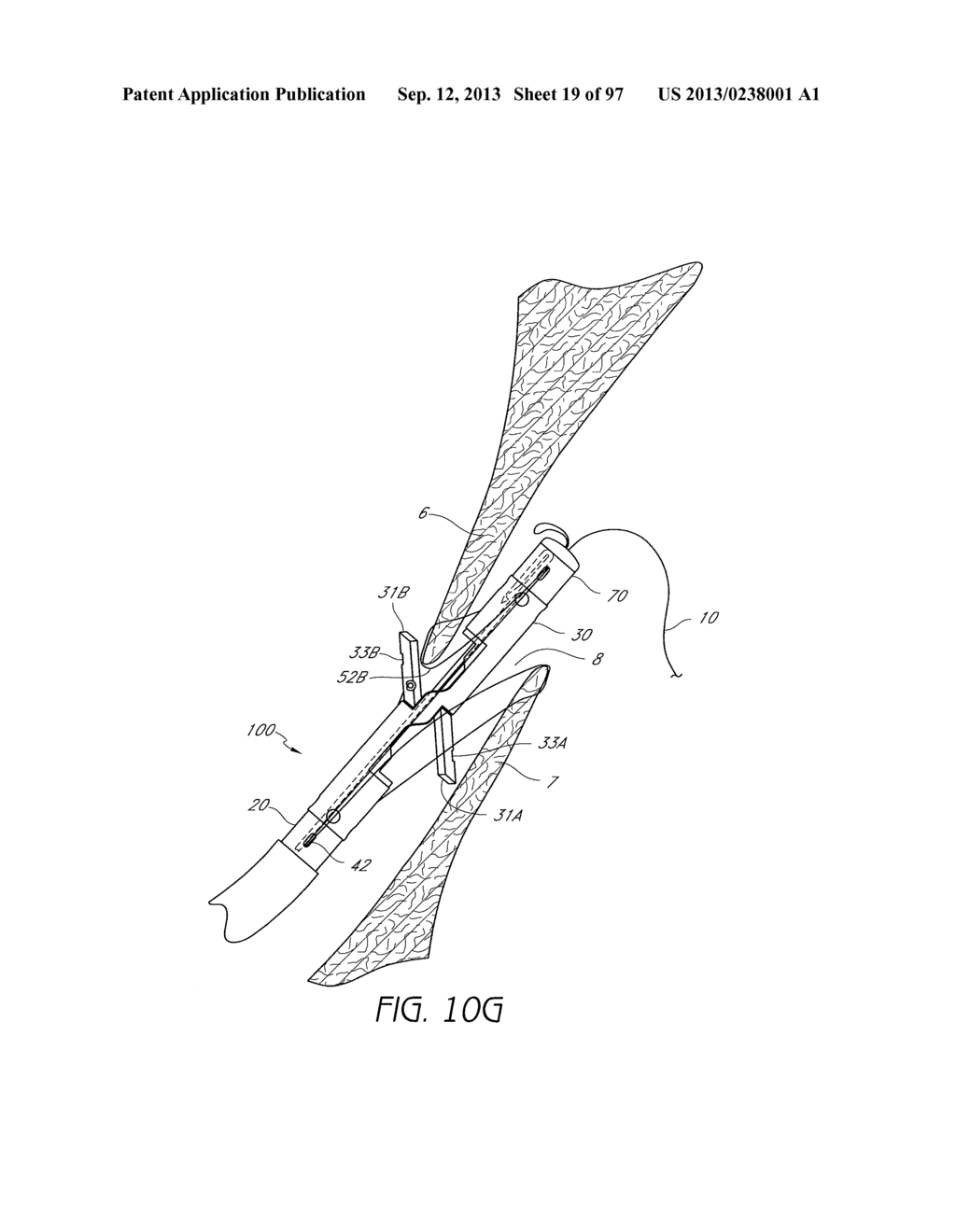 Suturing Devices and Methods for Closing a Patent Foramen Ovale - diagram, schematic, and image 20