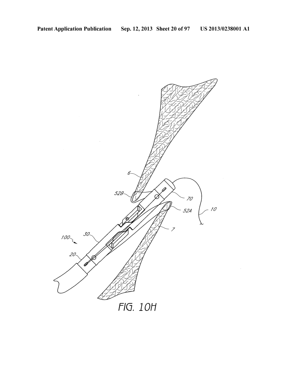 Suturing Devices and Methods for Closing a Patent Foramen Ovale - diagram, schematic, and image 21