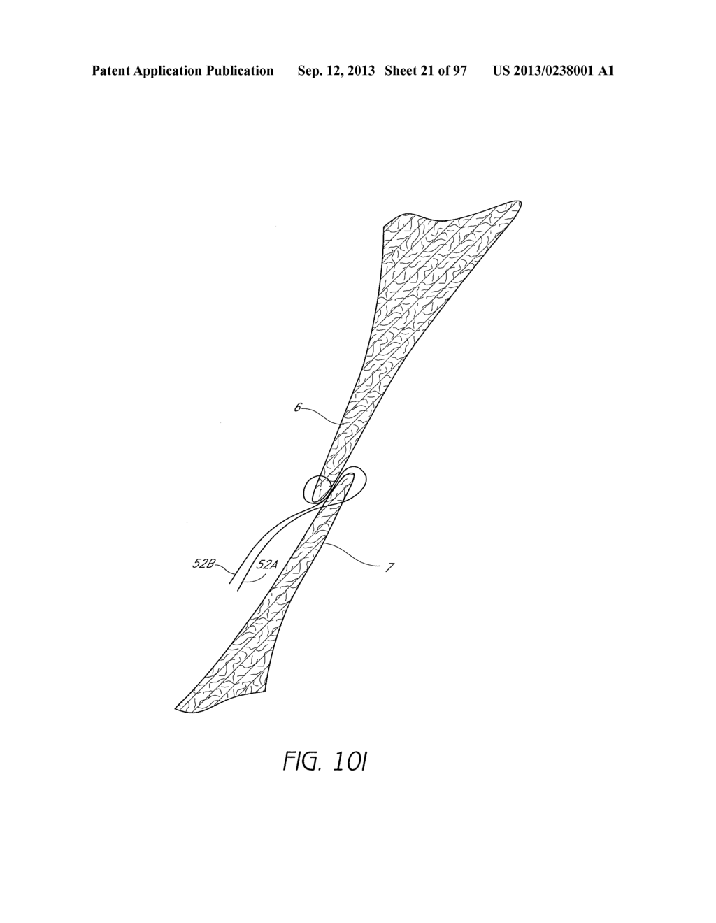 Suturing Devices and Methods for Closing a Patent Foramen Ovale - diagram, schematic, and image 22