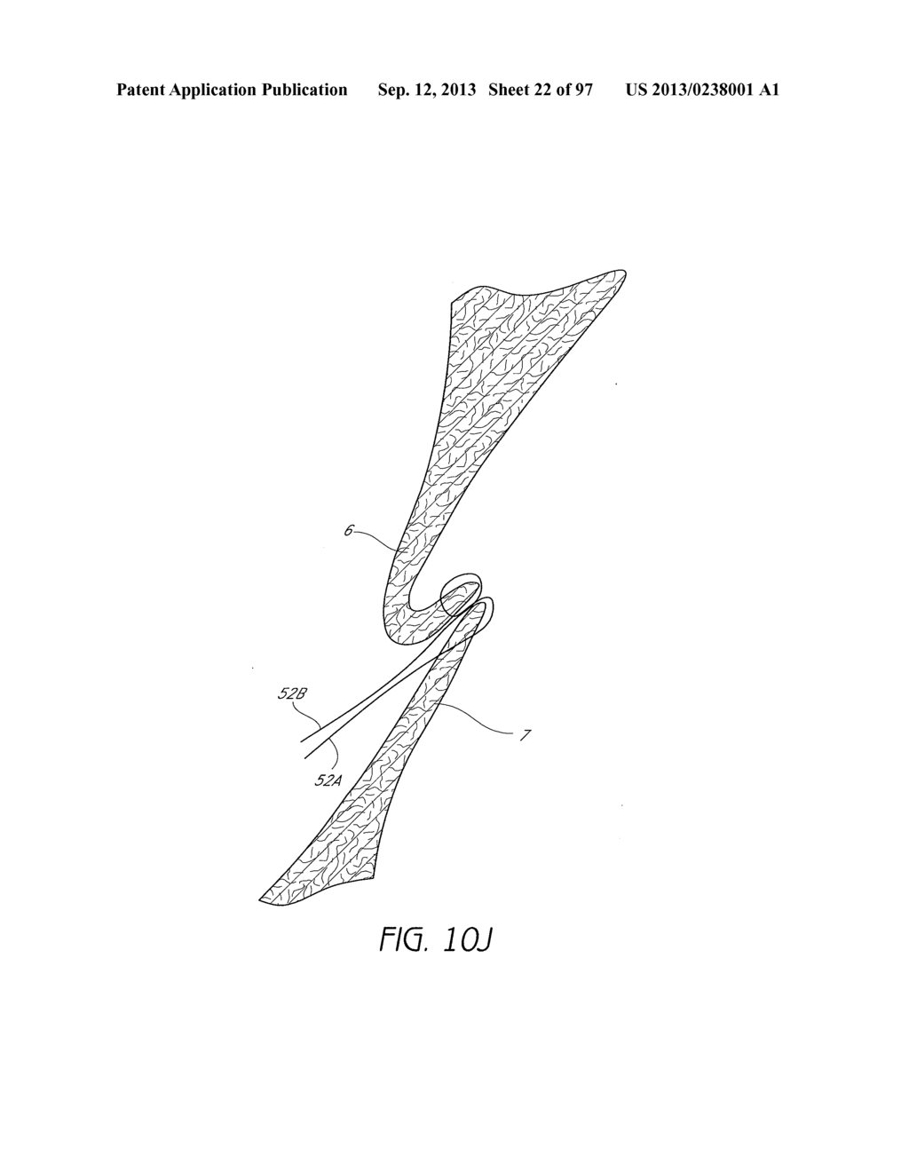 Suturing Devices and Methods for Closing a Patent Foramen Ovale - diagram, schematic, and image 23