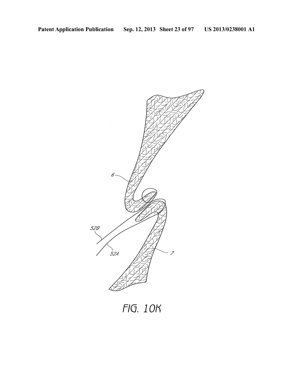 Suturing Devices and Methods for Closing a Patent Foramen Ovale - diagram, schematic, and image 24