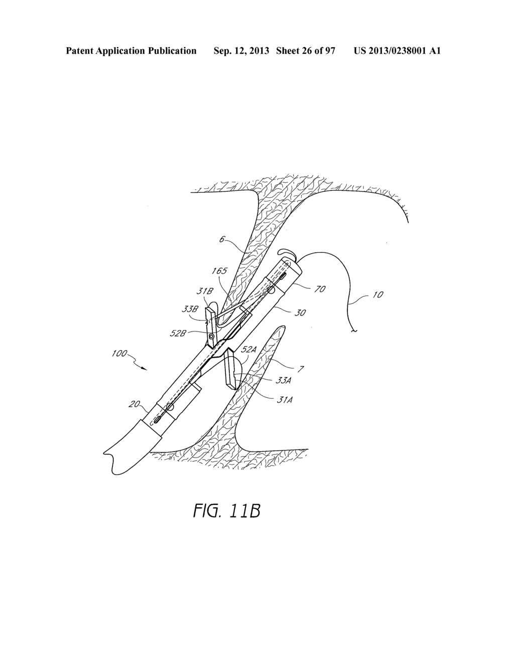 Suturing Devices and Methods for Closing a Patent Foramen Ovale - diagram, schematic, and image 27