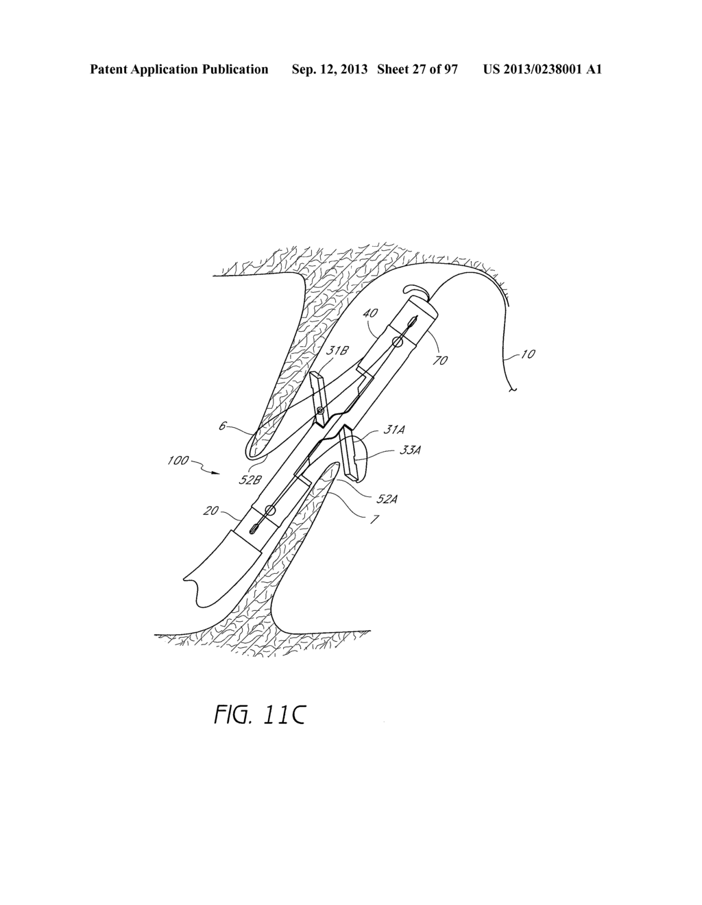 Suturing Devices and Methods for Closing a Patent Foramen Ovale - diagram, schematic, and image 28