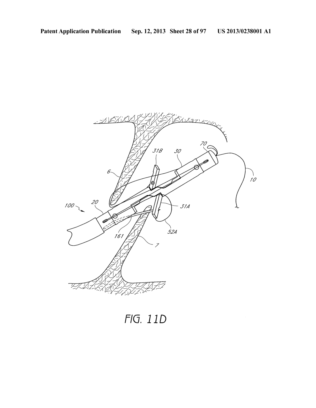 Suturing Devices and Methods for Closing a Patent Foramen Ovale - diagram, schematic, and image 29