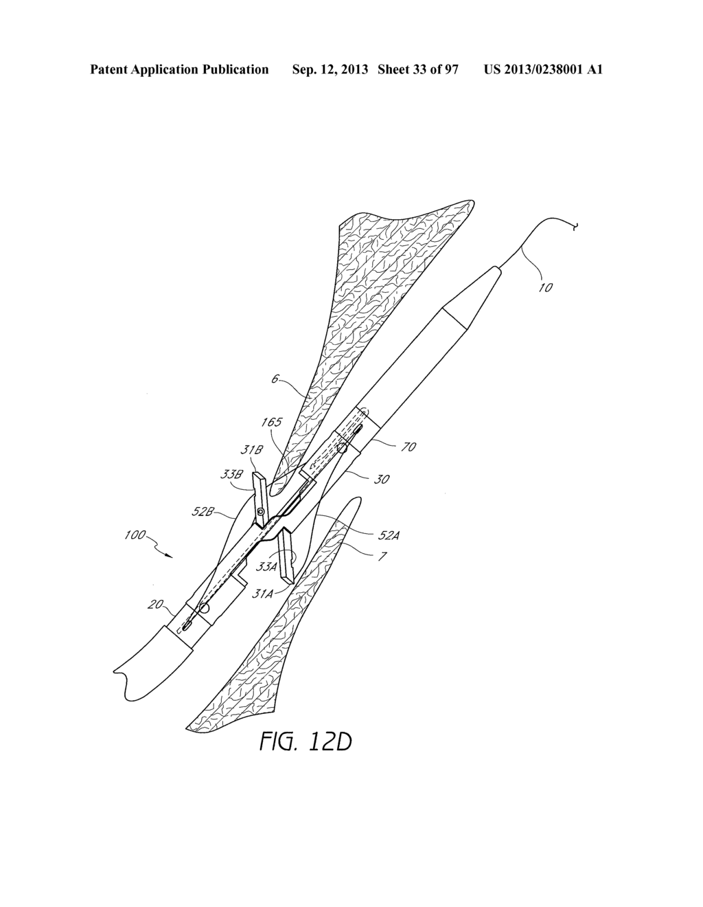 Suturing Devices and Methods for Closing a Patent Foramen Ovale - diagram, schematic, and image 34