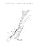 Suturing Devices and Methods for Closing a Patent Foramen Ovale diagram and image