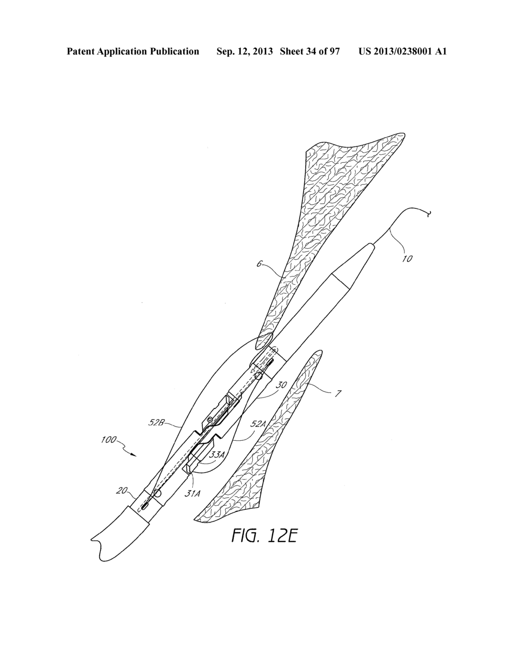 Suturing Devices and Methods for Closing a Patent Foramen Ovale - diagram, schematic, and image 35