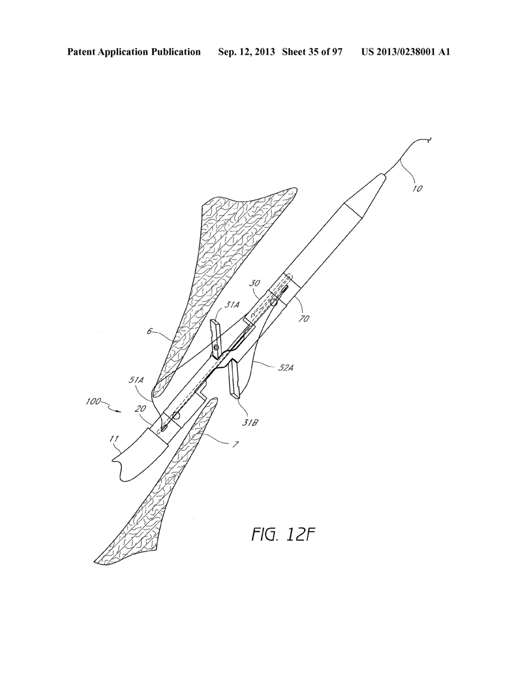 Suturing Devices and Methods for Closing a Patent Foramen Ovale - diagram, schematic, and image 36