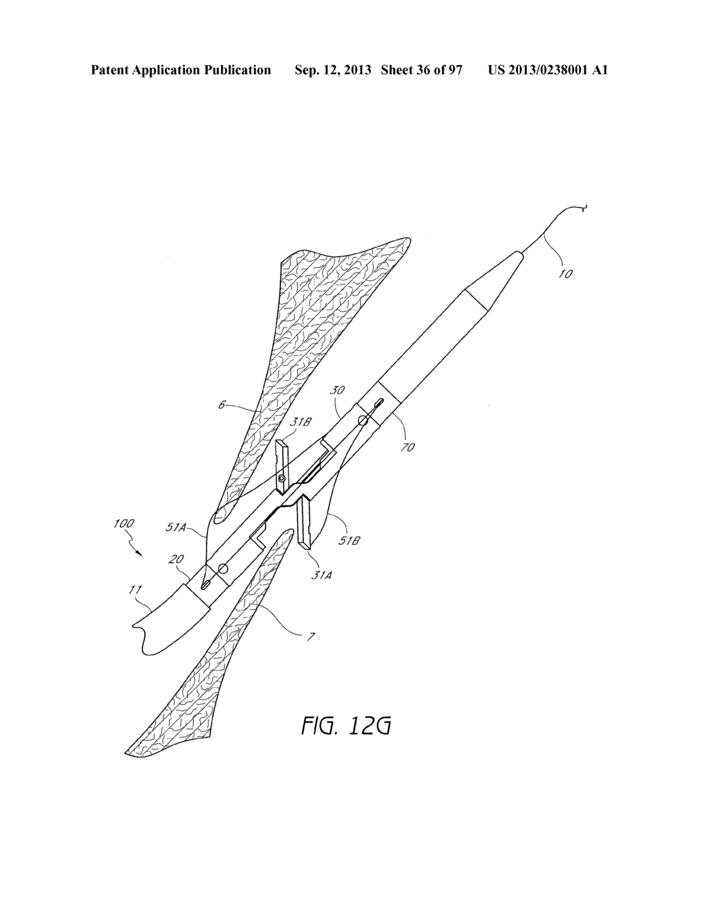 Suturing Devices and Methods for Closing a Patent Foramen Ovale - diagram, schematic, and image 37