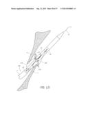 Suturing Devices and Methods for Closing a Patent Foramen Ovale diagram and image