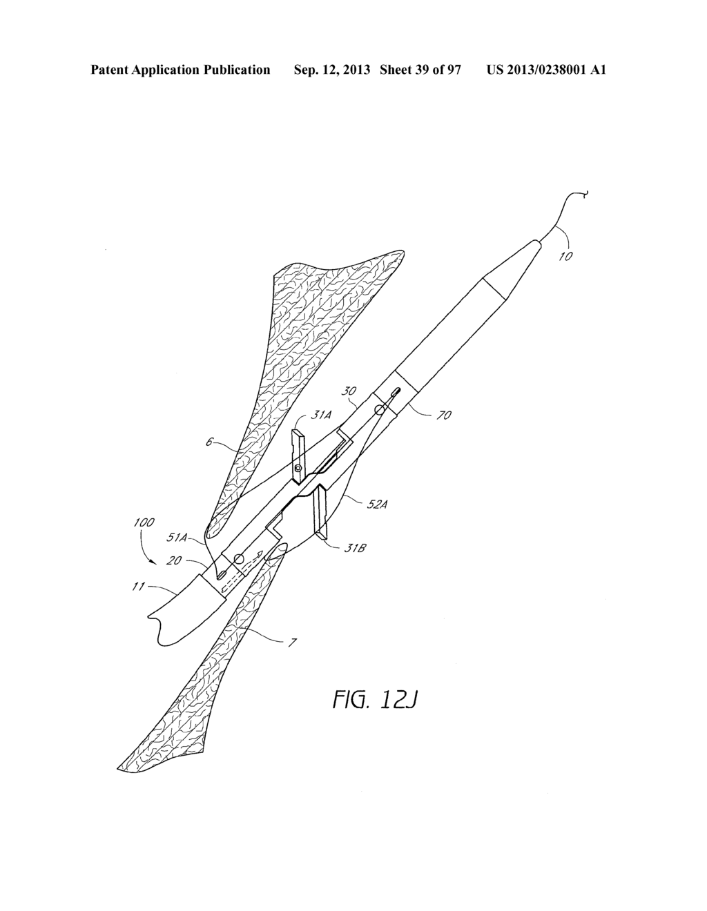 Suturing Devices and Methods for Closing a Patent Foramen Ovale - diagram, schematic, and image 40