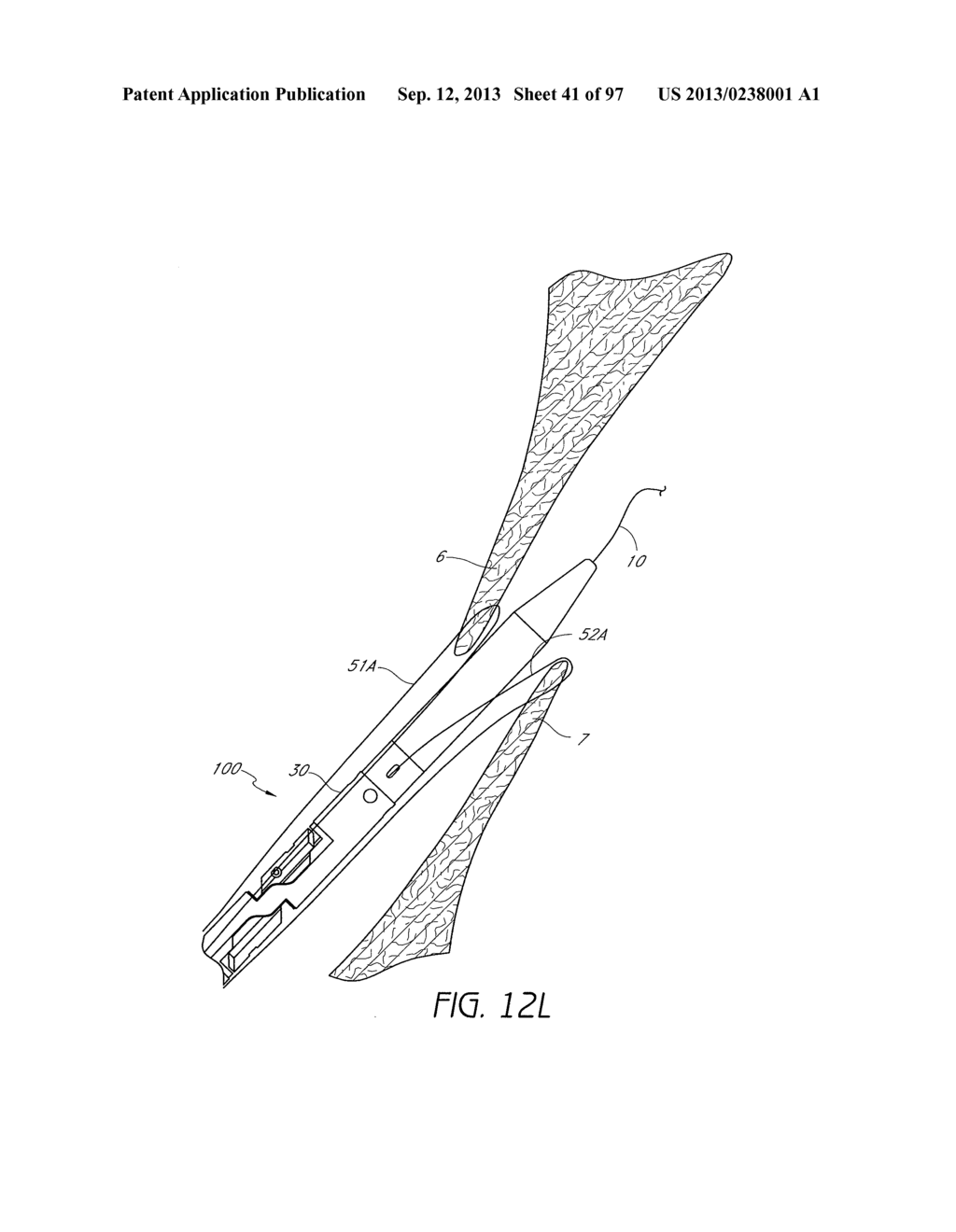 Suturing Devices and Methods for Closing a Patent Foramen Ovale - diagram, schematic, and image 42