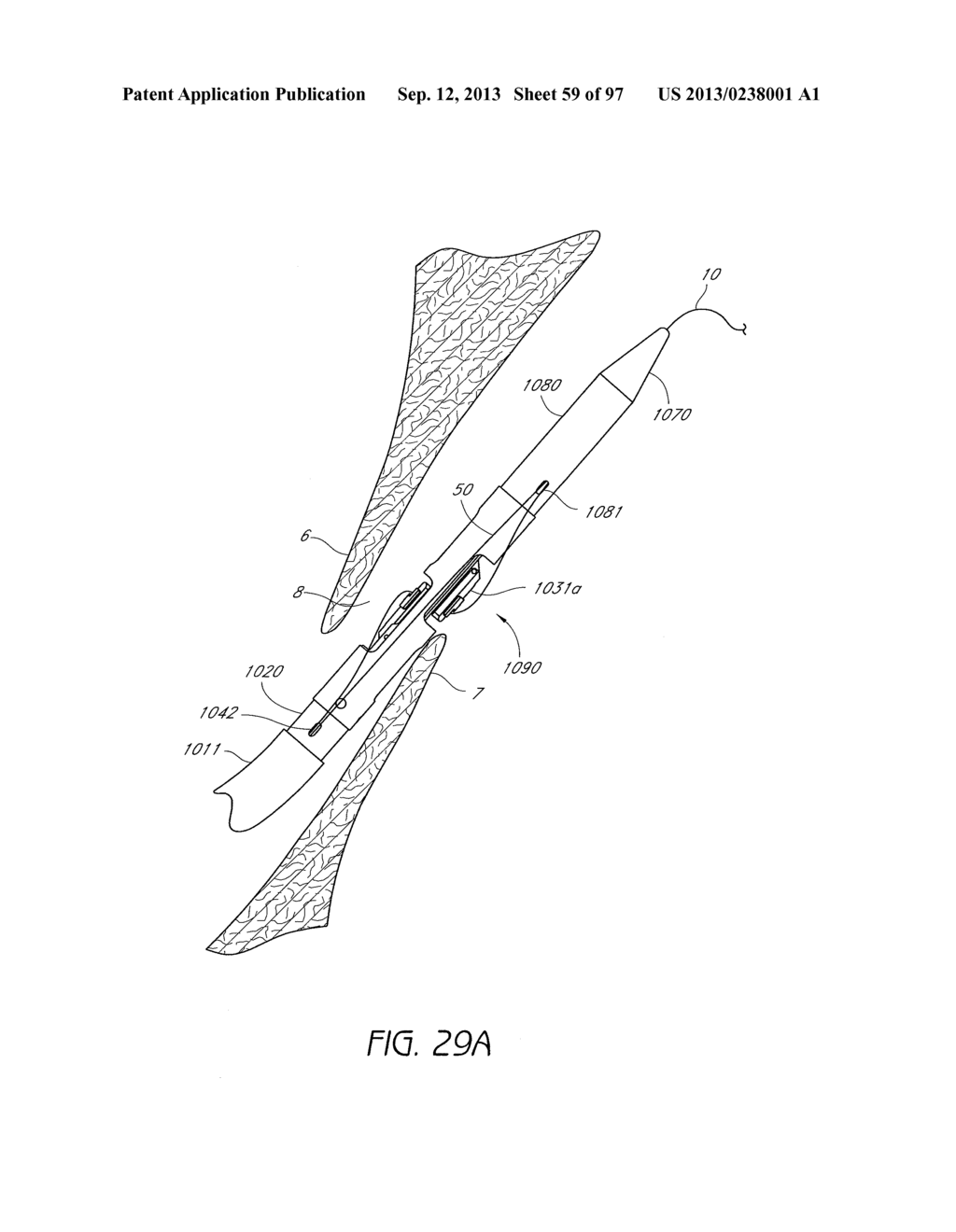 Suturing Devices and Methods for Closing a Patent Foramen Ovale - diagram, schematic, and image 60