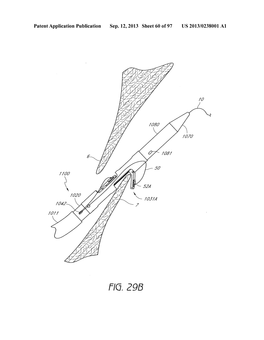 Suturing Devices and Methods for Closing a Patent Foramen Ovale - diagram, schematic, and image 61