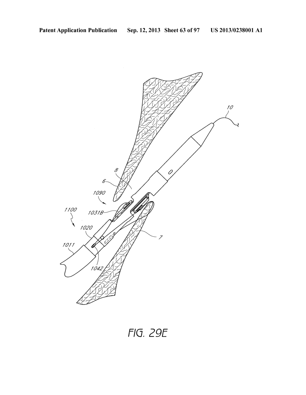 Suturing Devices and Methods for Closing a Patent Foramen Ovale - diagram, schematic, and image 64