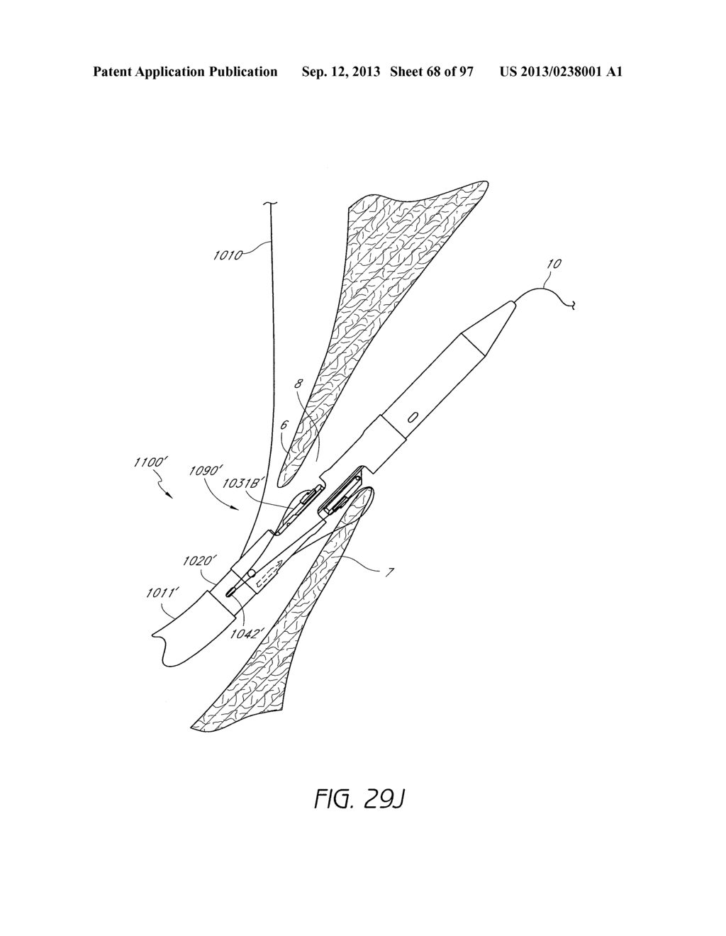 Suturing Devices and Methods for Closing a Patent Foramen Ovale - diagram, schematic, and image 69