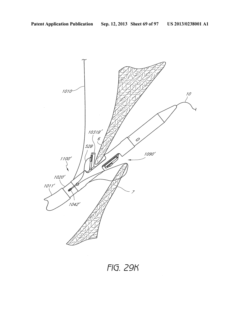 Suturing Devices and Methods for Closing a Patent Foramen Ovale - diagram, schematic, and image 70