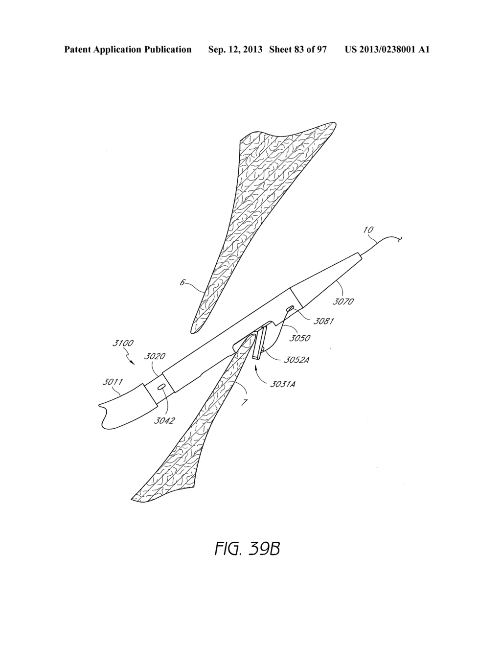 Suturing Devices and Methods for Closing a Patent Foramen Ovale - diagram, schematic, and image 84