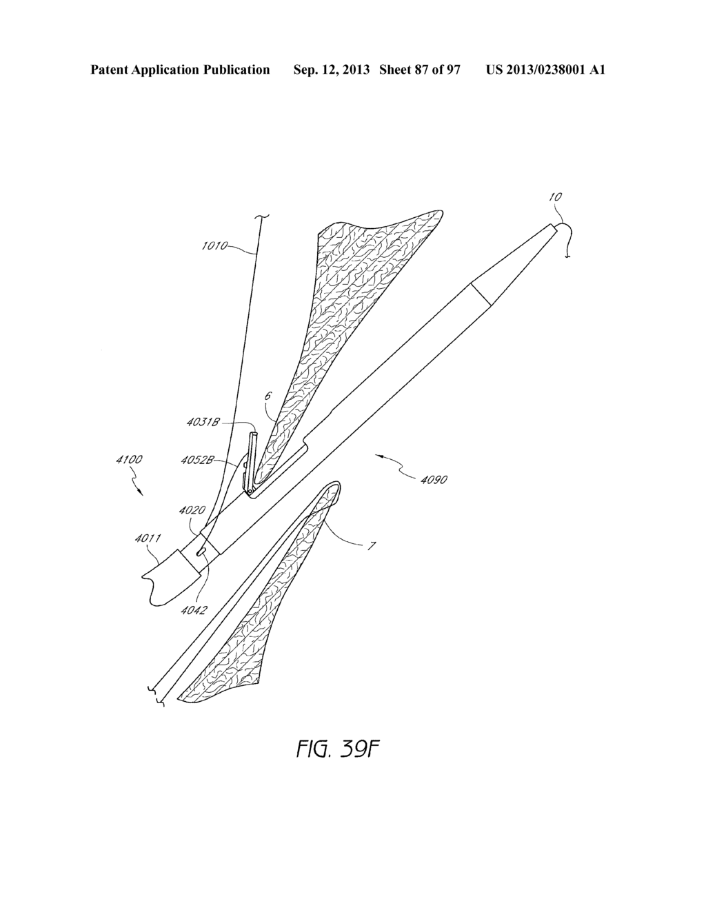 Suturing Devices and Methods for Closing a Patent Foramen Ovale - diagram, schematic, and image 88