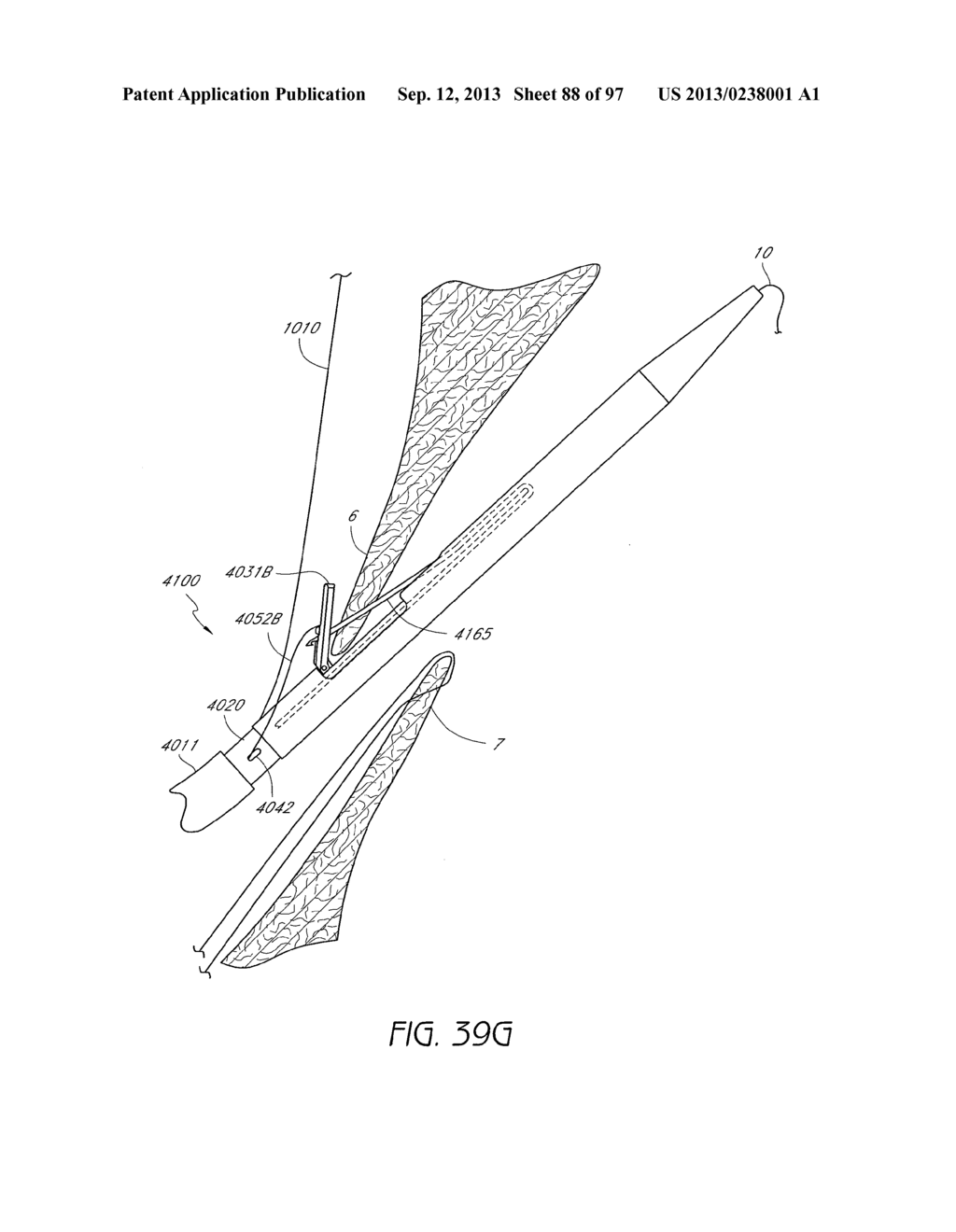 Suturing Devices and Methods for Closing a Patent Foramen Ovale - diagram, schematic, and image 89