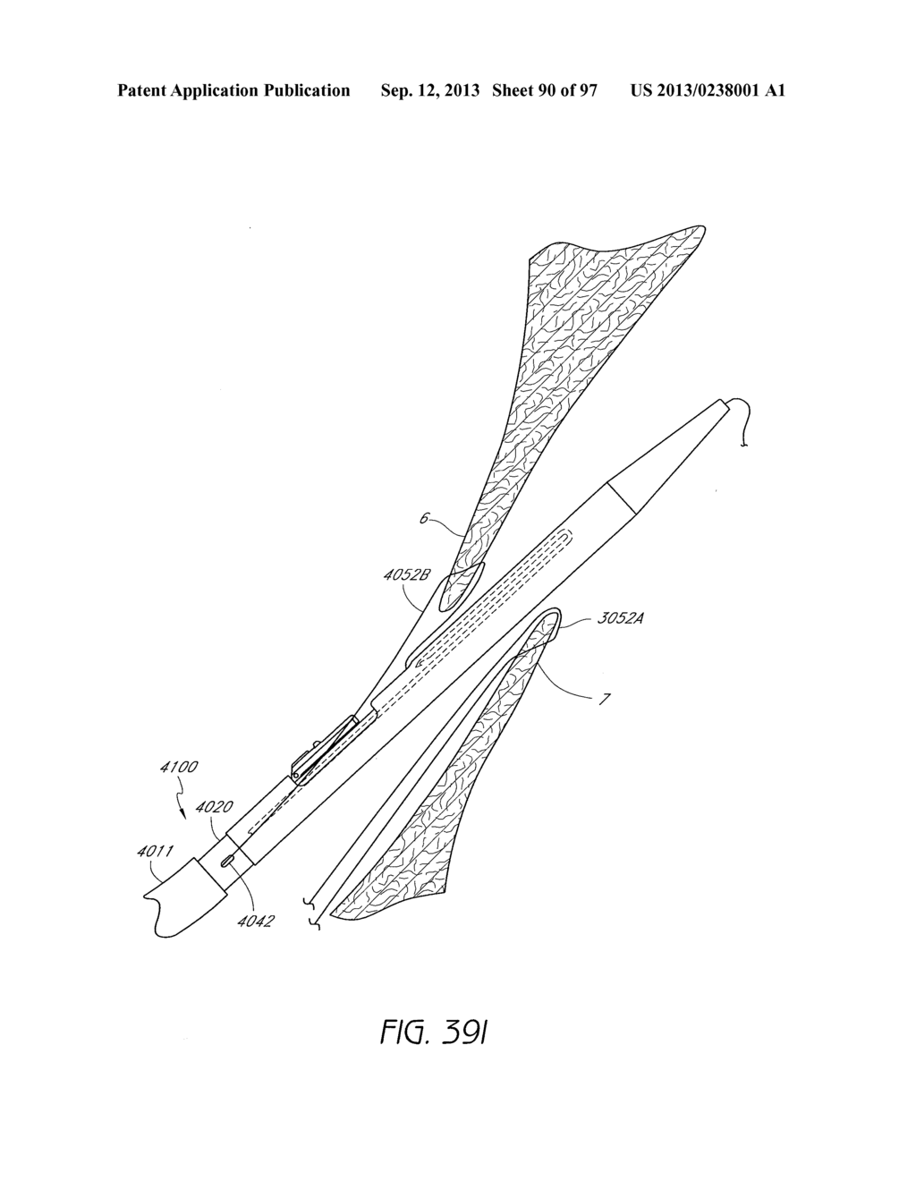 Suturing Devices and Methods for Closing a Patent Foramen Ovale - diagram, schematic, and image 91