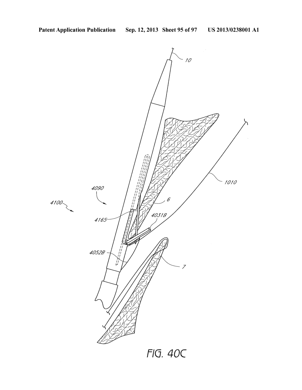 Suturing Devices and Methods for Closing a Patent Foramen Ovale - diagram, schematic, and image 96