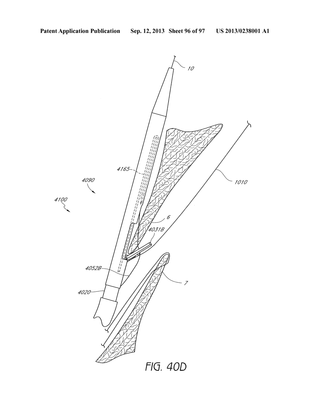 Suturing Devices and Methods for Closing a Patent Foramen Ovale - diagram, schematic, and image 97