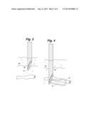 VEIN DISRUPTION DEVICE diagram and image