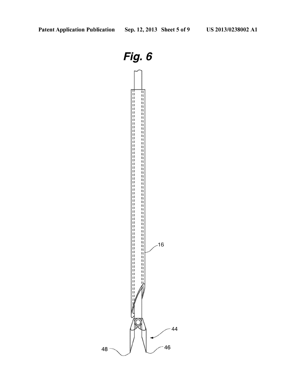 VEIN DISRUPTION DEVICE - diagram, schematic, and image 06