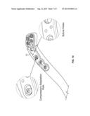 BONE PLATE AND AIMING BLOCK diagram and image