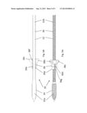 Bone Compression and Fixation Devices diagram and image